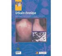 Urticaire Chronique Collectif (Auteur)