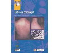 Urticaire Chronique - Séminaire Thématique De La Coordination D'allergologie Du Chu De Lyon