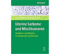 Uterine Sarkome Und Mischtumoren Gunter Kohler, Matthias Evert (Auteur)