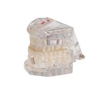UTHCLO Modèle Amovible Résine pour Démonstration et Enseignement Modèle Oral Détachable pour Implant et Bridge Équipement Pédagogique pour Étudiants et