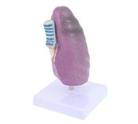 UTHCLO Modèle Pulmonaire Pathologique Éducatif pour Tabagisme Modèle Anatomique Respiratoire Outil Enseignement Physiologie et Anatomie Médicale