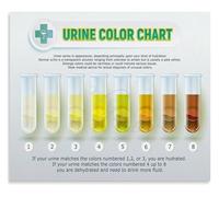 UYCUODLUY Educational Urine Color Chart Poster Human Body Knowledge Print for Home Gym Bedroom Living Room Decor Kidney Health Awareness Water Intake Guide(Unframed,16x24inch(40x60cm))
