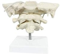 Vacoomcom Modèle éducatif modèle Occiput - Modèle de colonne cervicale humaine Modèle d'os occipital en PVC Atlas et axe avec os occipital pour aide à la formation médicale (couleur : A)