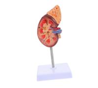 VALICLUD Modèle Anatomique De Rein Humain 1:1 Détachable Base Support Accessoire De Cours De Biologie Étudiants en Médecine Anatomie Démonstration Pédagogique Enseignement Pratique