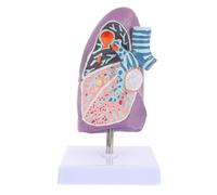 VALICLUD Modèle Anatomique Pulmonaire Pathologique de Fumeur Taille Moyenne Matériau Solide Modèle D’Enseignement Médical pour Écoles et Formation en Physiologie Respiratoire