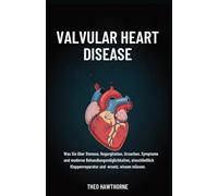 Valvular Heart Disease: Was Sie über Stenose, Regurgitation, Ursachen, Symptome und moderne Behandlungsmöglichkeiten, einschließlich Klappenreparatur und -ersatz, wissen müssen.