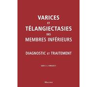 Varices et teleangiecasties des membres inferieurs: Diagnostic et traitement
