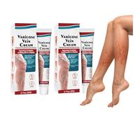 Varicose Veins Cream, Crème Contre les Varicosités, Araignée Veine Varices Veines Crème Pour Jambe, Pour Les Jambes Élimine Les Varices Et Les Varicosités