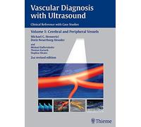 Vascular Diagnosis with Ultrasound: Clinical Reference with Case Studies Volume 1: Cerebral and Peripheral Vessels (v. 1) by Doris Neuerburg-Heusler (2005-12-01)