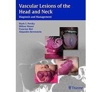 Vascular Lesions Of The Head And Neck