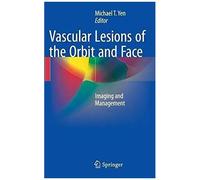 Vascular Lesions Of The Orbit And Face