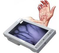 Vein Finder Viewer Adult Baby Handheld Vein Detector Transilluminator pour phlébotomie Clinique hospitalière pour Médecin Infirmière Utilisation Facile