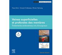 Veines Superficielles Et Profondes Des Membres - Traitements Endoveineux Et Chirurgicaux