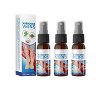 Veinhealing Spray des Varices, 1/2/3pcs Vaporisateur Miracle des Varices, Varicose Vein Soothing Spray, Varicose Veins Spray, Improve Blood Circulation