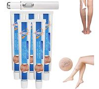 Venoheal Crème de traitement des varices, Crème de traitement des veines Relie, Traitement anti-varices pour les jambes, Crème de soin des varices Crème de soin des jambes, Stylo et crème de