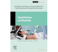 Ventilation artificielle