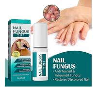 Vernis à ongles - Réparation d’ongle - Ongle liquide - Champignon - Main et Pied - Haute qualité