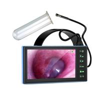 Verre Spéculum Vaginal,Écran de 7 pouces Camera endoscopique Kit d'observation pour dilatateur Vaginal Dilatateur Vaginal en Verre Creux Écarteur Anal Spéculum, avec Photo, Fonction vidéo(M)(M)