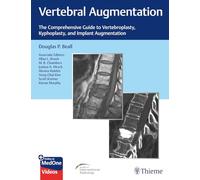 Vertebral Augmentation: The Comprehensive Guide to Vertebroplasty, Kyphoplasty, and Implant Augmentation