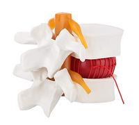 Vertebres Anatomie, Modèle de hernie, Modèle de vertèbres lombaires colonne vertébrale anatomique, modèle de démonstration médicale 1: 1,5 du discale Humaine de la Colonne vertébrale Lombaire