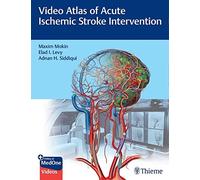 Video Atlas of Acute Ischemic Stroke Intervention by Adnan Siddiqui Adnan Siddiqui (Auteur)