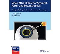 Video Atlas of Anterior Segment Repair and Reconstruction: Managing Challenges in Cornea, Glaucoma, and Lens Surgery