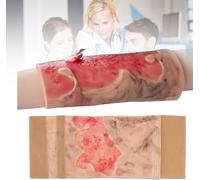 VILA SMO Modèle De Brûlure Simulée, Modèle D'entraînement pour Brûlures des Membres, Coussin De Blessure Portable De 2e À 3e Degré, pour l'enseignement des Soins Aux Brûlés Et La Formation Médicale