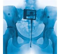 Virgin Édition Limitée Exclusivité Fnac Vinyle Vert "Bouteille de Coca" Vinyle