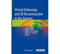 Virtual Endoscopy and 3D Reconstruction in the Airways