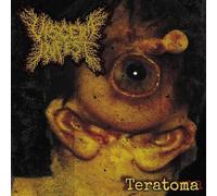 Viscera Infest - Teratoma