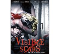 Visible Scars