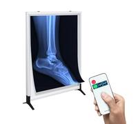 Visionneuse de films radiographiques portable avec télécommande, gradation à 3 niveaux, design ultra fin pour professionnels de la santé