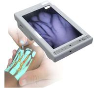 Visionneuse de veine rechargeable pour phlébotomie, outil de visualisation de la lumière veineuse d'accès IV pour plus d'efficacité