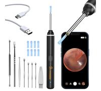 VITCOCO Otoscope pour Enlever le CéRumen, 1920p Wifi Otoscope Oreille, Nettoyage Oreille avec CaméRa, Otoscope avec 6 Led Pour Iphone, Ipad et Smartphones Android pour Adultes, Enfants, animal(Noir)