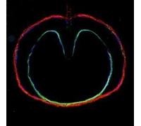 Wasp Star Apple Venus Volume 2 CD