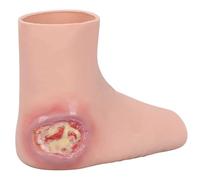 Wearable Heel Ulcère Blessure Training Sleeve, modèle réaliste de pied de silicone, kit réutilisable de pratique de soin de blessure, pour la démonstration de pratique de soin d'ulcère de décubitus