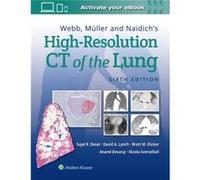 Webb Muller and Naidichs HighResolution CT of the Lung by Nicola Sverzellati Sujal Desai David Lynch Anand Devaraj Nicola Sverzellati (Auteur)
