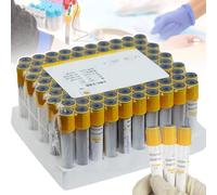 WhFKLca Lot de 100 Tubes De PréLèVement Sanguin sous Vide, Jetables en Verre De 3 ML/5 Ml/10 ML, avec Gel De SéParation Et Tube Coagulant, pour La SéParation du Sérum Et La PréParation du PRP,5ml