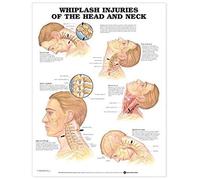 Whiplash Injuries Of The Head And Neck