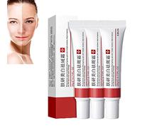 Whitening Freckle Cream,Acne Scar Removal Treatment Cream,Pigmentation Removal Cream For Face,Remove Melasma Acne Cream Fading Spot Cream,Dark Spot Corrector For Face (2PCS,Acne Relief)