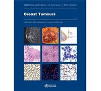 WHO Classification of Breast Tumours WHO Classification of Tumours Volume 2 by Edited by Who Classification of Tumours Editorial Board Edited by Who Classification of Tumours Editorial Board (Auteur)