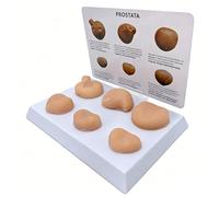 WHOOLEFUN Ensemble De Modèles De Prostate avec Pathologies, Modèle D'anatomie De Palpation De La Prostate, Outil De Formation sur Les Lésions du Système Reproducteur Masculin, avec Carte D'annotation