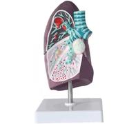 WLGDBXF Modèle de poumon pathologique, modèle d'anatomie Humaine, système respiratoire, modèle d'enseignement de l'anatomie, modèle d'organe Humain