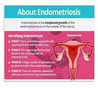 Womens Body Awareness Educational Guide Canvas Wall Art for Gynecology Office or Library(Framed,12x18inch(30x45cm))