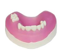 WOTZOV Modèle de crête alvéolaire - Modèle de Technique parodontale de Base - Modèle d'allongement de Couronne par curetage à Lambeau pour l'étude et l'enseignement