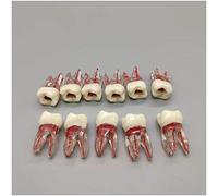 WOTZOV Modèle pédagogique, 11 pièces, modèle de Racines dentaires pour la Pratique, modèle d'anatomie canalaire pour l'enseignement et l'étude dentaires.
