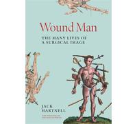Wound Man The Many Lives of a Surgical Image - Jack Hartnell - Princeton University Press - ebook (ePub) - Livre