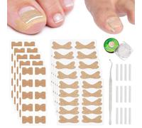 WUMZIRA 150 Pcs Kit Correcteur d'Ongle Incarné, Patchs de Correction Professionnels avec 100 Autocollants Papillon, 50 Bandes de Redressement et 1 Curette, Soin des Pieds pour Ongle Incarne Gros