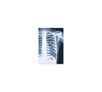 X-Ray