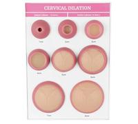 XCSCUK Ensemble de modèles de Dilatation cervicale, simulateur de Dilatation cervicale, avec 0-8 cm, modèle d'examen gynécologique, pour l'éducation des Femmes Enceintes
